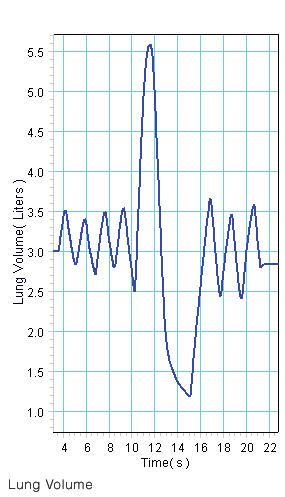 Wireless Spirometer